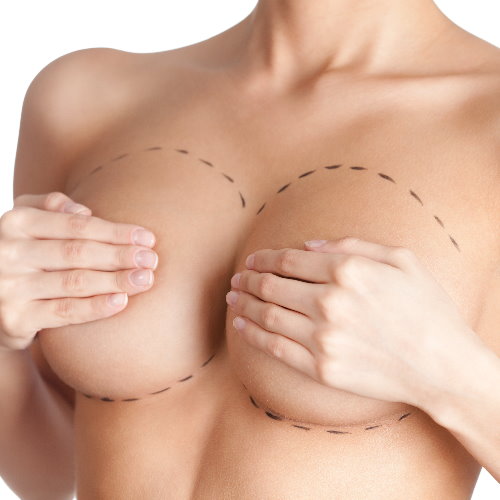 隆乳手術完整分析介紹 - 手術前必看推薦完整攻略