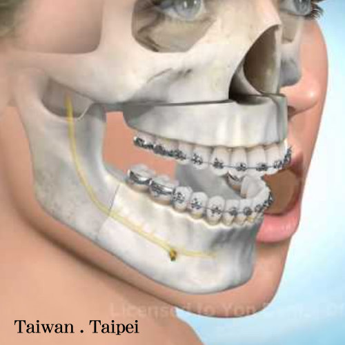 台北正顎手術權威醫師推薦