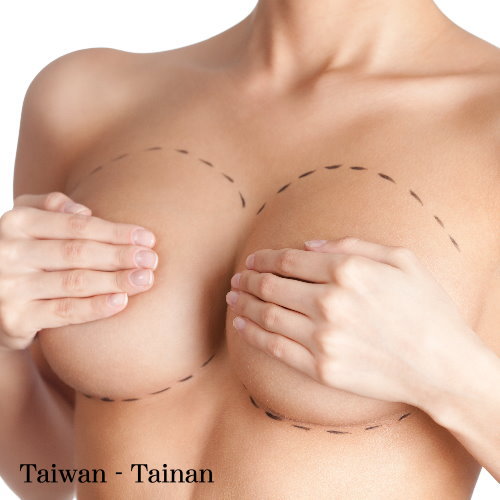 台南隆乳手術權威醫師推薦