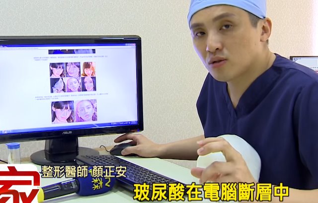AngelaBaby沒有整型？台醫師：有疑點