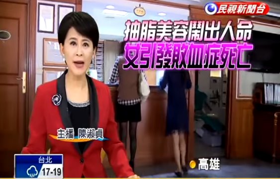 整形愛美要當心，55歲婦人抽脂敗血症死亡