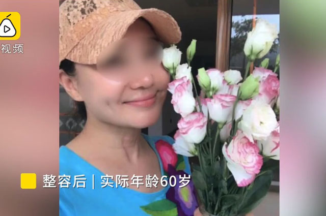 驚！ 60歲大媽為躲債動刀變臉成20歲少女