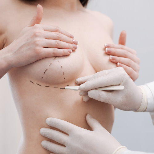 2024隆乳手術最新資訊完整揭露，消費者必看隆乳說明書