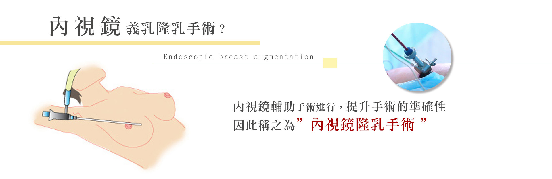 二次隆乳重要輔助工具-內視鏡義乳隆乳手術 非自體材料進行的隆乳手術，目前的材質從鹽水袋到果凍矽膠，近期的水滴型果凍矽膠都屬於義乳隆乳手術的選擇材料，而在進行手術的過程中，目前大多會使用內視鏡輔助手術進行，提升手術的準確性，因此稱之為內視鏡隆乳手術。