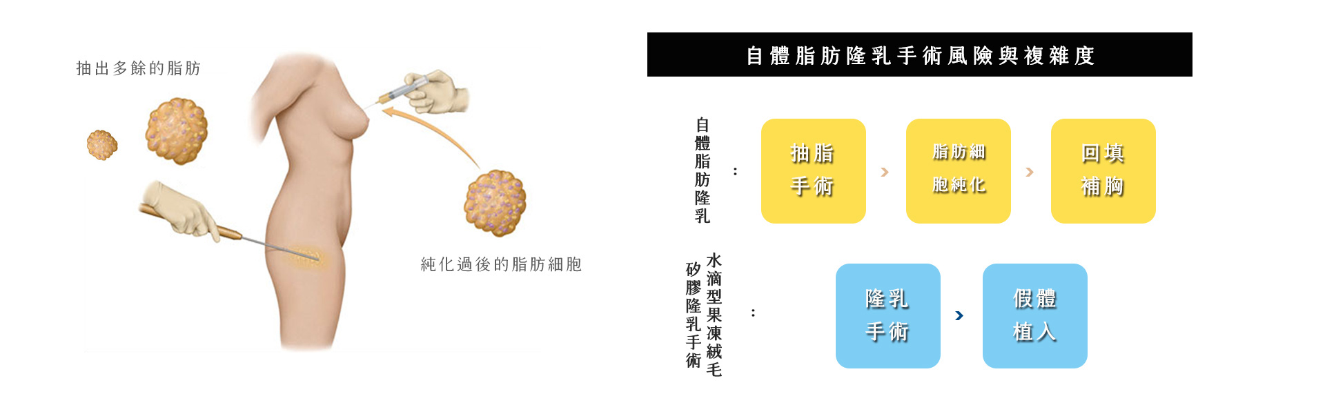 無論是植入義乳還是自體脂肪隆乳，都需要由經驗豐富醫生謹慎評估再操刀