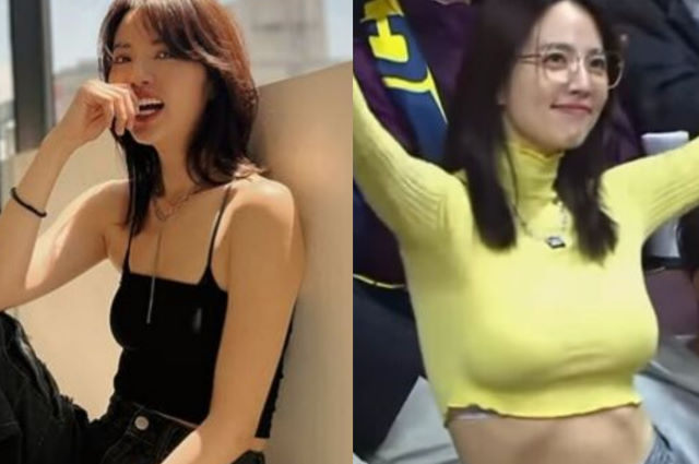 台灣藝人阿諾隆乳坦率分享美胸心路歷程